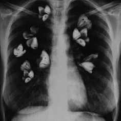 Love is...❤ Lungs, Butterflies, Wattpad, Flowers, White