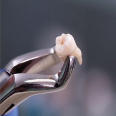 RECENT STUDIES show that a nanoscale view of tooth enamel could lead to a solution for enamel-regenerating tooth treatments! Tooth Extraction Aftercare, Tooth Extraction Healing, Dental Implants Cost, Pediatric Dental