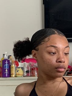 Acne Black Women, Pretty Acne Aesthetic, Clear Skin Black Aesthetic, Acne Women, Girl With Acne, Acne Girls Pretty, Black Woman Clear Skin, Clearskin Aesthetic Girl, Pimple Scars