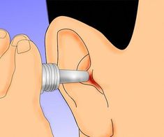 Water or fluid in the ears can be annoying, but you don't have to live with it. While fluid will usually drain out on its own, you can help the process along with a few simple tricks. Empty the fluids by using simple maneuvers that you can... How To Get Fluid Out Of Inner Ear, Fluid In Ears How To Get Rid Of, How To Unstop Ears, Ear Congestion, In Ears, Cramps Relief, Stain On Clothes