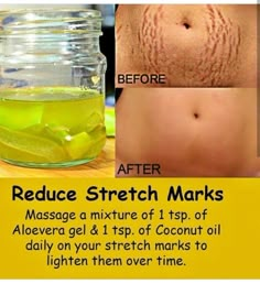 Natural Stretch Mark Remedies, Beginner Skin Care Routine, Natural Skin Care Ingredients, Skin Care Basics, Skin Care Ingredients, Natural Skin Care Remedies, Natural Face Skin Care