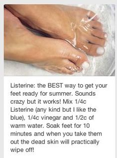 Dry Cracked Heels, Home Health Remedies, Cracked Heels, Beauty Skin Care Routine, Health And Beauty Tips, Beauty Treatments, Beauty Secrets, Beauty Care