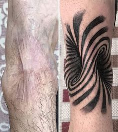 Times People Asked Tattoo Artists To Cover Up Their Scars And Birthmarks Cover Up Scar Tattoos Men, Neck Scar Tattoo Cover, Vertical Scar Tattoo Cover Up, Knee Scar Tattoo Cover Up, Arm Scar Tattoo, Knee Scar Tattoo, Tattoos On Scars, Arm Scar Tattoo Coverup, Trans Scar Tattoo