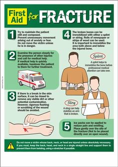 First Aid For Fracture. If someone next to you has a fracture, DON'T PANIC! There are some things that you can do.   For more tips on treating fractures, read the following article and learn how to use a SAM Splint for stabilizing broken bones or sprained joints and keep bad injuries from getting worse: http://insidefirstaid.com/personal/first-aid-kit/splinting-bone-fractures-with-a-sam-splint #first #aid #tips #medical #injuries #fracture #bones First Aid Poster, First Aid For Kids, First Aid Cpr, First Aid Tips, Emergency First Aid, Bone Fracture, Occupational Health, Medical Knowledge