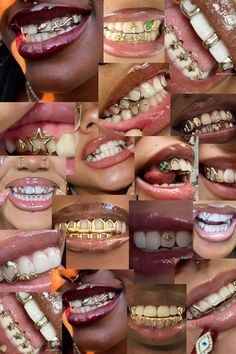 Aesthetic Grills Teeth, Grills And Tooth Gems, Golds On Black Women Teeth, Grills On Crooked Teeth, Grills On Gap Teeth, Woman With Grills, Grills Black Women Aesthetic, Grillz On Women, Simple Grill Design Teeth