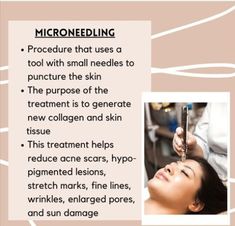 Micro Needling Facial, What Is Microneedling, Aesthetic Treatments, Derma Rolling, Skin Needling, Micro Needling, Facial Peel, Healthy Lifestyle Habits, Skin Tissue