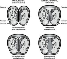 four stages of the human body in three different stages, including diaphonic and endocinotic