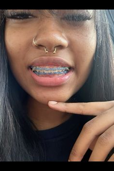 black girl braces Braces On Brown Skin, Lime Green Braces, Black Braces On Black People, Black Girls With Braces, Lavender Braces