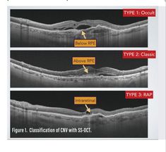 Opthalmic Technician, Eye Health Facts, Optometry Education, Optical Coherence Tomography, Human Skeletal System, Optometry School, Medical Ultrasound, Anatomy Coloring Book, Eye Anatomy