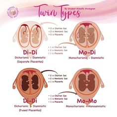 the different types of twins are shown in this diagram, and there is no image to describe