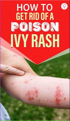 a person with red spots on their arm and the text how to get rid of a poison ivy rash