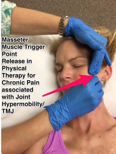 Hypermobility Exercises, Fascial Release Massage, Ehlers Danlos Syndrome Exercise, Hypermobile Ehlers Danlos Syndrome, Masseter Muscle Massage, Eds Ehlers Danlos Syndrome Exercise, Masseter Muscle, Elhers Danlos Syndrome Hypermobility