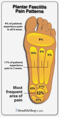 Facitis Plantar, Plantar Fascia, Foot Pain Relief, Foot Reflexology, Heel Pain, Foot Health, Foot Pain, Health Info, Massage Therapy