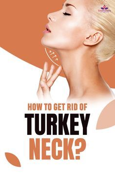 Turkey Neck Exercises, Get Rid Of Turkey Neck, Neck Fat Exercises, Face Lift Exercises