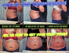 THIS CUSTOMER USED THE ULTIMATE BODY APPLICATOR AND JUST LOOK AT THAT TRANSFORMATION!   IF YOU ARE INTERESTED IN TRYING OUT ANY OF THE IT WORKS PRODUCTS, PLEASE CONTACT ME!   HTTP://WWW.FACEBOOK.COM/ITWORKSBYSHANNONSHORES Get Out Of Debt, One Team, You Really, Life Changes, It Works, Look At, Skin Care, Skin