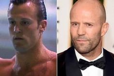 bald man in tuxedo before and after plastic surgery