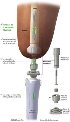 the procedure is performed to treat and remove an unhealthy substance from the utensil