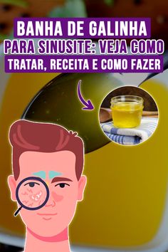 Banha de galinha para sinusite: Como tratar, receita e como fazer! #gargantainflamada #gripe #resfriado #tosse #tosseseca #tossealergica #chá #tosseembebe #aliviartosseemcriança #tossecomcatarro #chaparatosseseca #banhadegalinhaparagripe #banhadegalinhacomel #chaparatosse #sinusite #renitealergica #chaparagripe #melparagripe #melparatosse #comotrataratosse #comotrataragripe #comoeliminartosseseca #comoeliminartosse #remedioscaseirosparatosse #receitascaseirasparatosse #remediocaseiroparagripe