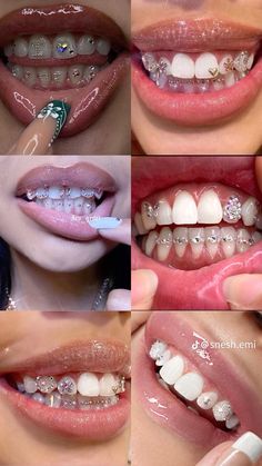 Tooth Gems Ideas Grill, Diamond Teeth Jewelry, Simple Teeth Gems, Toothgems Ideas, Teeth Diamond, Teeth Jewels, Tooth Gem Gap Teeth, Tooth Gems Aesthetic Simple, Teeth Gems Aesthetic