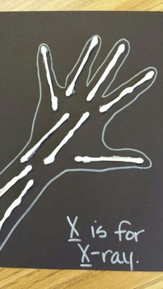 a chalk drawing of a hand with x is for x - ray written on it