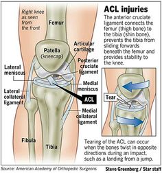 Acl Surgery, Acl Tear, Musculoskeletal System, Human Anatomy And Physiology, Orthopedic Surgery, Knee Pain Relief, Medical Anatomy, Body Anatomy