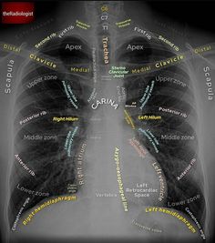 an x - ray shows the chest and lungs with words written all over it