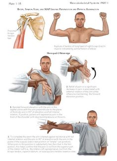 BICEPS, TENDON TEARS, AND SLAP LESIONS Slap Tear Exercises, Bicep Tendon Tear, Bicep Tendon, Biceps Muscle, Shoulder Anatomy, Muscle Belly, Shoulder Pain Exercises, Yoga Muscles