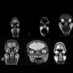 multiple views of the human skull with different facial expressions, including an x - ray