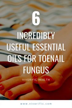 What exactly is toenail fungus?Toenail fungus is a common disease caused by an infection in and around the toenail. The most common toenail fungus is called "onychomycosis". The presence of toenail fungus is usually known due to the symptoms since they are quite noticeable if the fungus has not yet been Treating Toenail Fungus, Aloe Vera For Sunburn, Remedies For Dry Mouth, Toenail Health, Toenail Fungus Remedies, Natural Remedies For Migraines, Nail Fungus Remedy, Nail Infection, Dry Skin Remedies