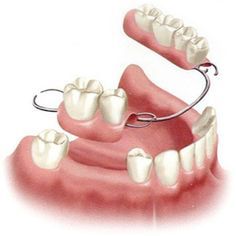 Denture Adhesive, Perfect Teeth, Missing Teeth