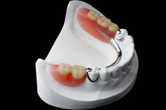 Denture Repairs, Affordable Dentures, Teeth Health