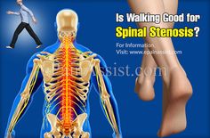 Is Walking Good for Spinal Stenosis? Range Of Motion, Back Pain, Health Benefits, Motion