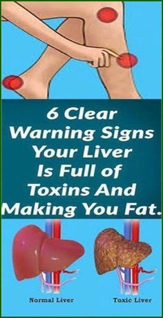 https://gabihealth.com/6-signs-that-your-liver-is-full-of-toxins/ Quadrants Of The Abdomen, Recipe Hacks, Liver Issues, Itching Skin, Digestion Problems, Detox Smoothie, Health Awareness, Warning Signs, Healthy Kids