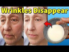 With This Powerful Mask, You Will Look Younger And Wrinkle-free. Instead of spending too much money to get rid of wrinkles, try this wrinkle removal mask. It... Face Wrinkles Remedies, Wrinkles Remedies Face, Mouth Wrinkles, Cover Wrinkles, Wrinkle Remedies, Wrinkle Free Skin, Skin Care Wrinkles, Face Wrinkles