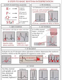 Ekg Interpretation Made Easy, Healthy Doughnuts, Nursing School Studying Cheat Sheets, Nursing School Life, Nursing Pictures, Nurse Skills, Np School, Ecg Interpretation