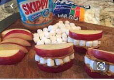 Health Preschool, Tooth Party, Kids Dental Health, Childrens Dental Health