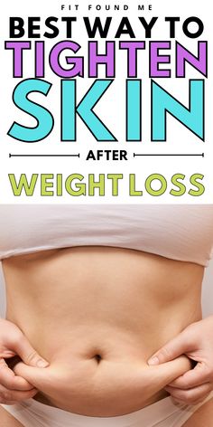 Excess Skin, Travel Plan, Lose 50 Pounds