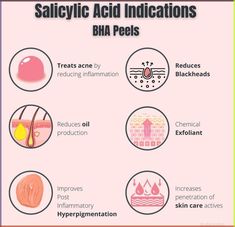 Salicylic acid indications BHA peels Acne On Nose, Derma Facial, Skin Care Pictures, Acne Soap, Acne Toner, Pimples On Face, Acne Face, Face Soap