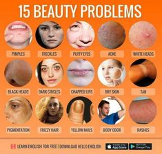 the poster shows different types of skin problems