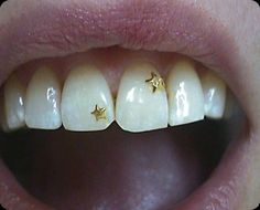 a woman's smile with gold stars on her teeth and the words zubivorme