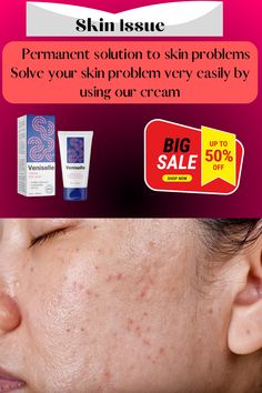 Have you been suffering from skin problems for a long time? Your skin is unusually swollen or damaged So use our product now without delay Your problem will be solved for sure #how_to_solve_face_skin_problems #how_to_solve_skin_allergy_problem #skin_issue_solve_fast #skin_issue_solve_for_cream #skin_issue_solve_for_face #skin_issue_solve_girl Your Skin