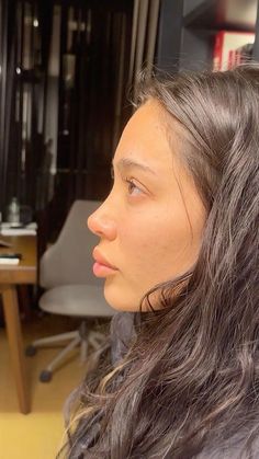 Small Nose Rhinoplasty, Long Nose Rhinoplasty, Good Nose Jobs, Nose Jobs Inspiration, Thick Nose Rhinoplasty, Button Nose Rhinoplasty, Nose Inspo Rhinoplasty, Botten Nose, Nose Job Reference