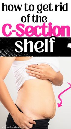 A woman trying to get rid of her postpartum belly or c-section shelf and the best tips to lose the c-section belly. Excersise For Belly Flat Stomach After C Section, Workout For Flat Stomach After C Section, Stomach Overhang Exercise, C Section Belly Exercises, Workout Post C Section, C Section Incision Healing, Ab Workout After C Section, Post Cesarean Workout Exercises, Csection Postpartum Exercise