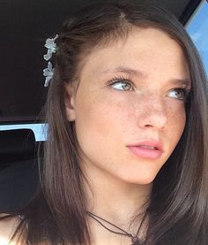 a woman with freckles on her head sitting in a car