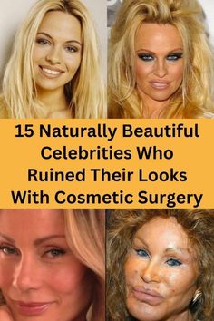 Celebrities Then And Now Plastic Surgery Before After, Failed Plastic Surgeries, Celebrities Before And After Surgery, Celebrity Plastic Surgery Before After, Plastic Surgery Before And After, Cameron Diaz Plastic Surgery, Celebrity Makeup Fails, Plastic Surgery Fails, Celebrity Bathrooms