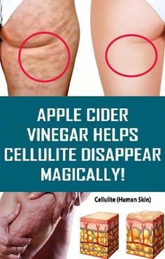 Health Tips For Women, Diy Health, Lose 40 Pounds, Health Info, Health And Beauty Tips, Health Advice, Natural Medicine, Cider Vinegar, Apple Cider Vinegar