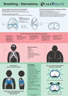 QualiBreath is the only external chest support that helps a patient to breathe more easily while the sternum receives a constant lateral support. Educational Poster, Medical Knowledge, Critical Care