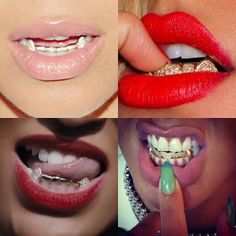 tooth grills for women - Google Search.... >> See more by checking out the picture link Gold Grill Women, Teeth Grills For Women, Grill Women, Gangsta Grillz, Teeth Grills