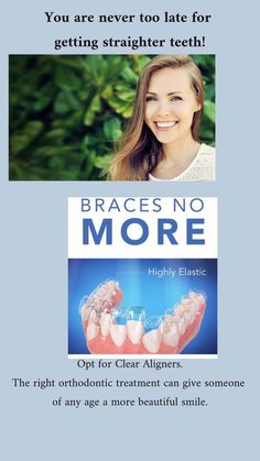 Invisible Braces, Straight Teeth, Clear Aligners, Patient Education, Never Too Late, Dental Clinic, Beautiful Smile, Dental Care