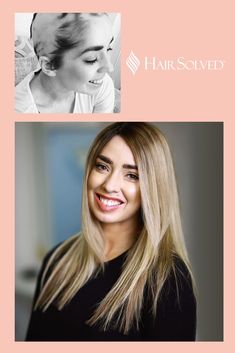 We have devised the most natural, beautiful, durable and bespoke hair enhancement system in the UK. We believe our innovative Enhancer System is the best treatment and solution for most types of hair loss… helping you to feel more confident, content and attractive. #notawig Scarring Alopecia, Alopecia Universalis, Alopecia Awareness, Androgenetic Alopecia, Hair Wash, Hair Done, Lost Hair